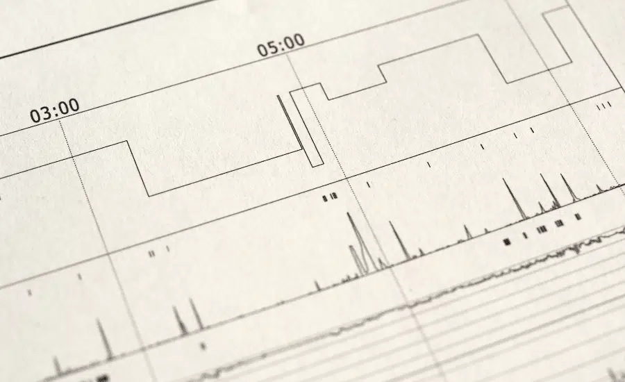 Polygraphie ventilatoire nocturne : un examen pour détecter l'apnée du sommeil